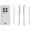 Elastyczne etui + 2x folia na ekran Bizon Case Clear Pack do Honor Magic7 Pro